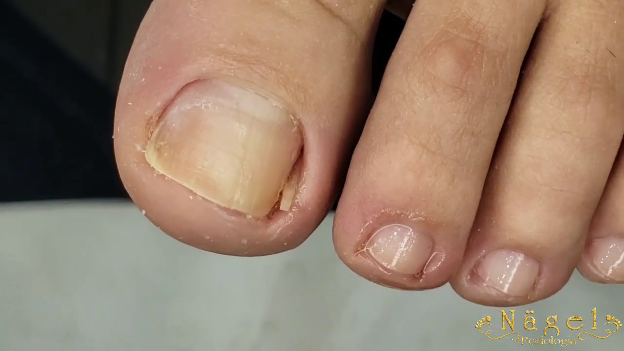 Assista a Apresentação